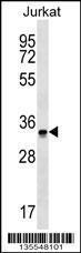 Anti-OR2G6 Rabbit Polyclonal Antibody (FITC (Fluorescein Isothiocyanate))