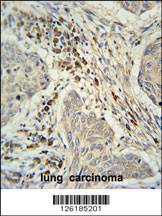 Anti-KXD1 Rabbit Polyclonal Antibody (PE (Phycoerythrin))