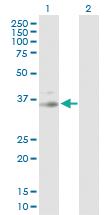 Anti-PRKG1 Rabbit Polyclonal Antibody