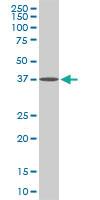 Anti-SPP1 Mouse Monoclonal Antibody [clone: 3B11]