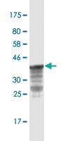 Anti-PRKCD Mouse Monoclonal Antibody [clone: 2F3]