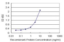 Anti-DCTD Polyclonal Antibody Pair