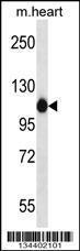 Anti-ACTN2 Rabbit Polyclonal Antibody (FITC (Fluorescein Isothiocyanate))