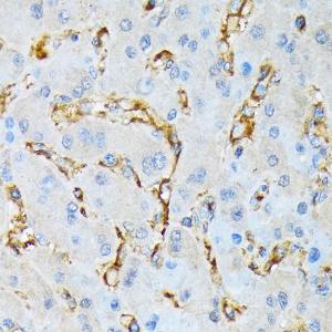 Anti-IQGAP1 Rabbit Monoclonal Antibody [clone: ARC1739]