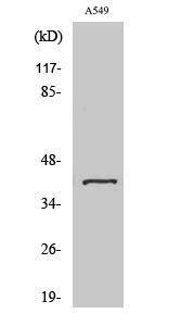 Western blot analysis of various cells using Anti-Sarcoglycan-beta Antibody