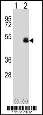 Anti-PAX6 Rabbit Polyclonal Antibody