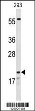 Anti-CLK2 Rabbit Polyclonal Antibody