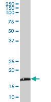 Anti-NDUFB6 Mouse Polyclonal Antibody