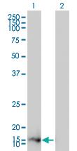 Anti-ZMAT4 Mouse Monoclonal Antibody [clone: 7H3-1C11]