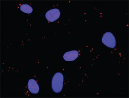 Anti-IKBKB + CREBBP Antibody Pair