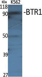 Western blot analysis of various cells using Anti-SLC4A11 Antibody