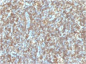 Anti-ds DNA antibody