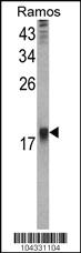 Anti-UBE2B Rabbit Polyclonal Antibody