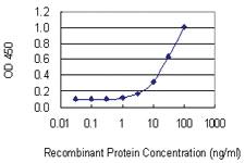 Anti-PDLIM1 Mouse Monoclonal Antibody [clone: 2D4]