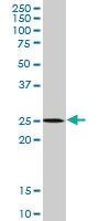 Anti-ATG5 Mouse Monoclonal Antibody [clone: 4B7]