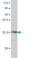 Anti-UBB Mouse Monoclonal Antibody [clone: 1F5]