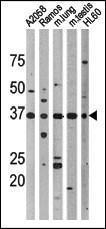 Anti-TP53 Rabbit Polyclonal Antibody (AP (Alkaline Phosphatase))