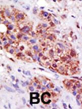 Anti-UBE2B Rabbit Polyclonal Antibody