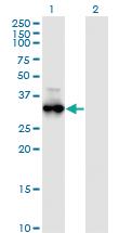 Anti-PRKG1 Mouse Monoclonal Antibody [clone: 5E5]