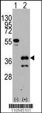 Anti-ZIC4 Rabbit Polyclonal Antibody (FITC (Fluorescein))