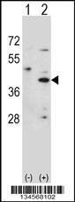 Anti-HSD3B1 Rabbit Polyclonal Antibody (HRP (Horseradish Peroxidase))