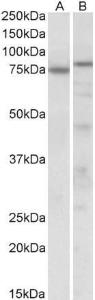 Anti-TP63 Antibody (A82702) (0.3 µg/ml) staining of Mouse (A) and Rat (B) Heart lysate (35 µg protein in RIPA buffer). Primary incubation was 1 hour. Detected by chemilu minescence