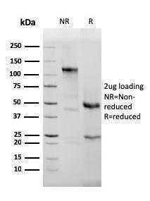 SDS-PAGE analysis of Anti-EPX Antibody [rEPO104] under non-reduced and reduced conditions; showing intact IgG and intact heavy and light chains, respectively. SDS-PAGE analysis confirms the integrity and purity of the antibody