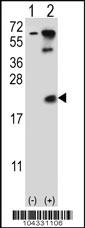 Anti-UBE2B Rabbit Polyclonal Antibody