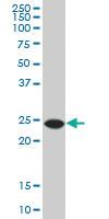 Anti-ATG5 Mouse Monoclonal Antibody [clone: 2G8]