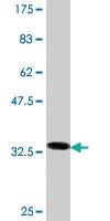 Anti-FOXC2 Mouse Monoclonal Antibody [clone: 3H3]