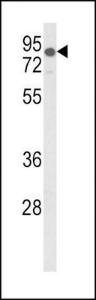 Anti-Lipoprotein Receptor, Low Density Rabbit Polyclonal Antibody (HRP (Horseradish Peroxidase))