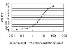 Anti-PRKG1 Mouse Monoclonal Antibody [clone: 5E5]