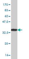 Anti-FOXC2 Mouse Monoclonal Antibody [clone: 2H3]