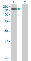 Anti-SMC3 Mouse Polyclonal Antibody