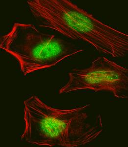 Anti-SUMO, Pan Rabbit Polyclonal Antibody