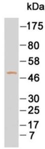 Western blotting using purified IgG4 under reducing conditions