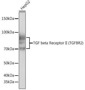 Western blot analysis of extracts of HepG2 cells, using Anti-TGF beta Receptor II Antibody [ARC0407] (A308902) at 1:500 dilution