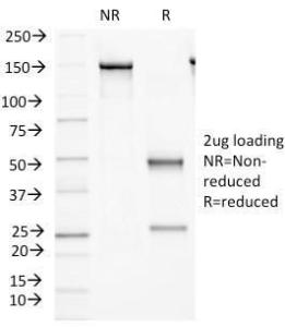 SDS-PAGE analysis of Anti-FAT2 Antibody [8C5] under non-reduced and reduced conditions; showing intact IgG and intact heavy and light chains, respectively. SDS-PAGE analysis confirms the integrity and purity of the antibody