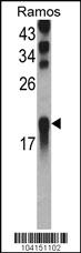 Anti-UBE2L3 Rabbit Polyclonal Antibody