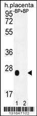 Anti-OR2J3 Rabbit Polyclonal Antibody (AP (Alkaline Phosphatase))