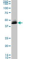 Anti-SPP1 Mouse Monoclonal Antibody [clone: 4H7]