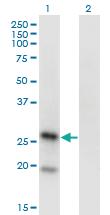 Anti-KLRAP1 Mouse Monoclonal Antibody [clone: 1H3]