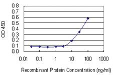 Anti-TIMP3 Mouse Monoclonal Antibody [clone: 1D8]