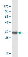 Anti-FOXC2 Mouse Monoclonal Antibody [clone: 2H3]