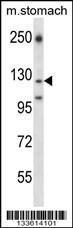 Anti-LAMC2 Rabbit Polyclonal Antibody (HRP (Horseradish Peroxidase))