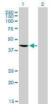 Anti-TARDBP Mouse Monoclonal Antibody [clone: 2E2-D3]