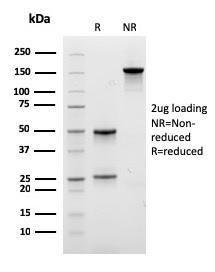 SDS-PAGE analysis of Anti-EPX Antibody [EPX/3908R] under non-reduced and reduced conditions; showing intact IgG and intact heavy and light chains, respectively. SDS-PAGE analysis confirms the integrity and purity of the antibody