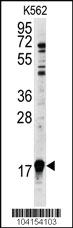 Anti-UBE2L3 Rabbit Polyclonal Antibody