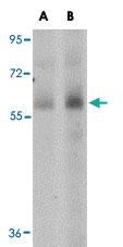 Anti-SCARB1 Rabbit Polyclonal Antibody