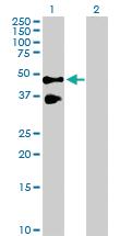 Anti-TNFRSF10B Rabbit Polyclonal Antibody